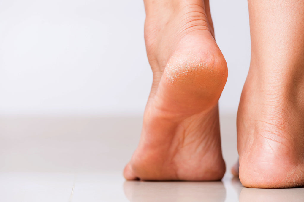 Shop Foot Heel Balm/Cream in Australia – PodiMe Foot Care