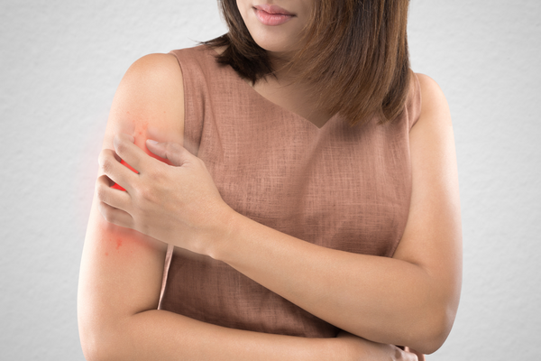 Health Conditions Linked to Psoriasis