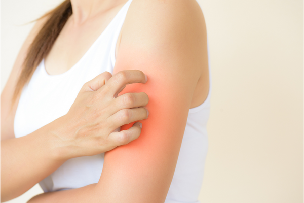 Causes of Eczema Flare-ups